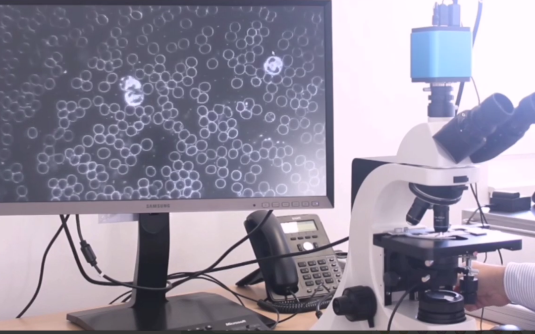 Dunkelfeldmikroskopie – Blutuntersuchung