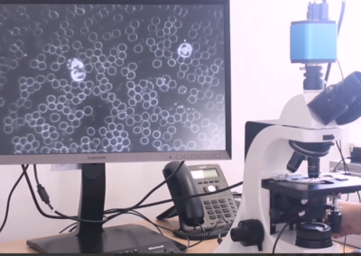 Dunkelfeldmikroskopie – Blutuntersuchung